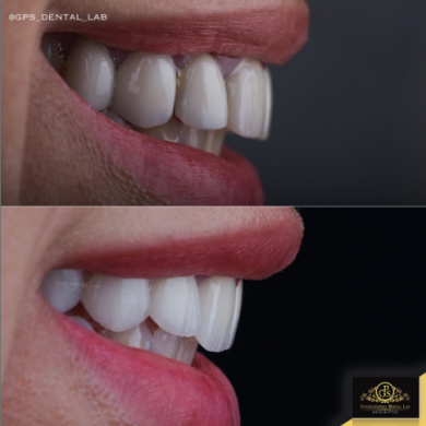 تصميم ابتسامة